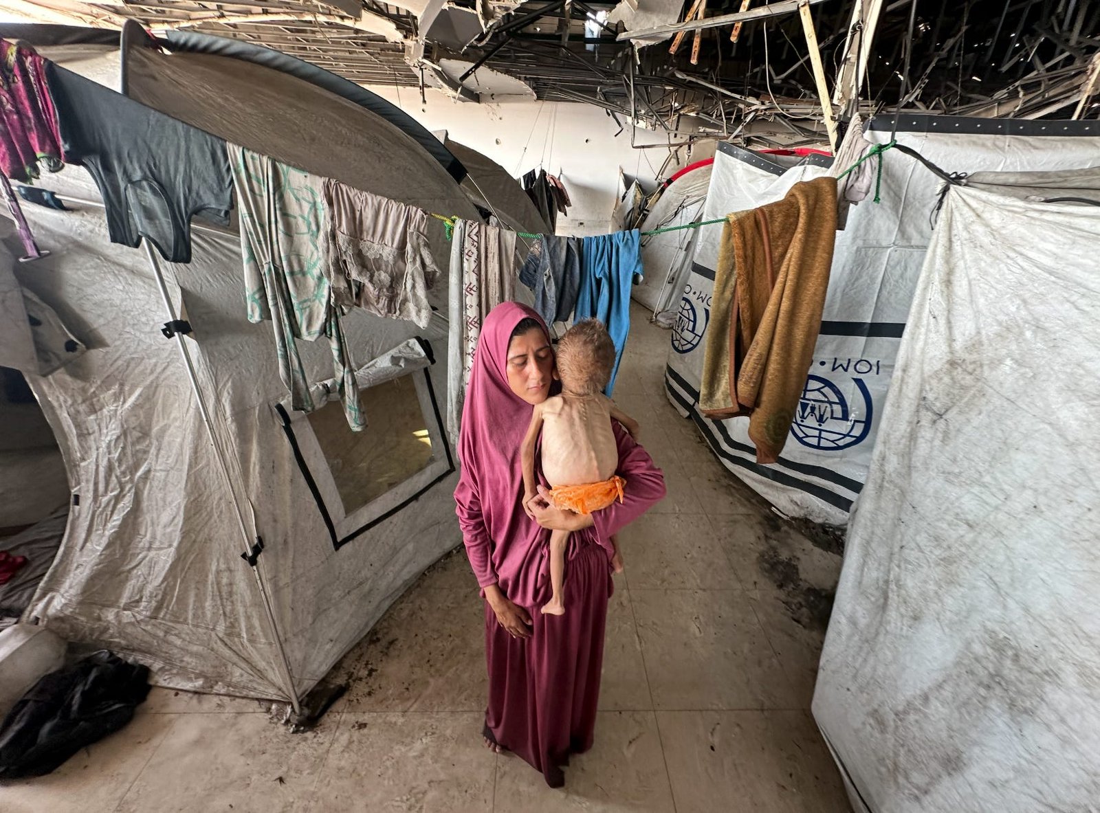 The Free Press Called Out "Incomplete" Reporting on Gaza's Starving Children. Here's the Complete Story.