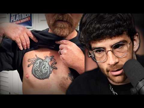 So He Covered The Tattoo...