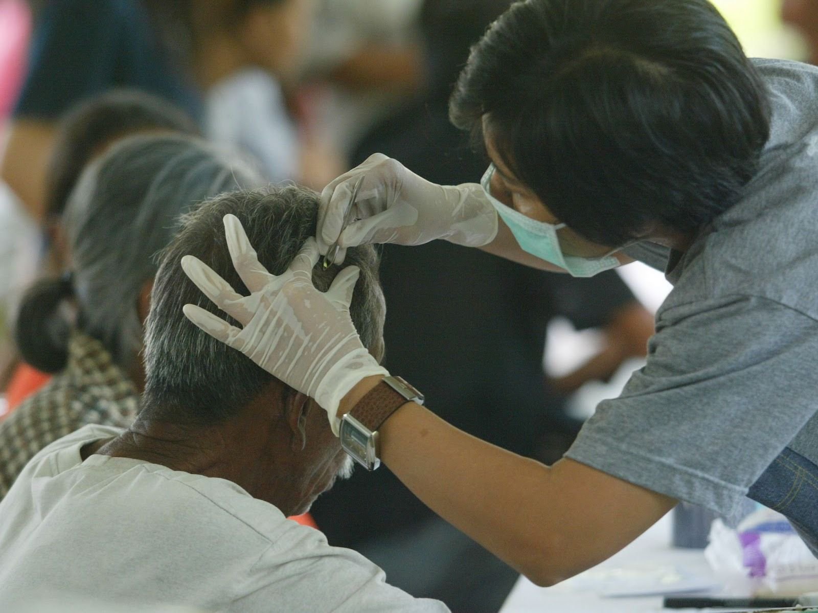 Hair samples show lead exposure falling in US