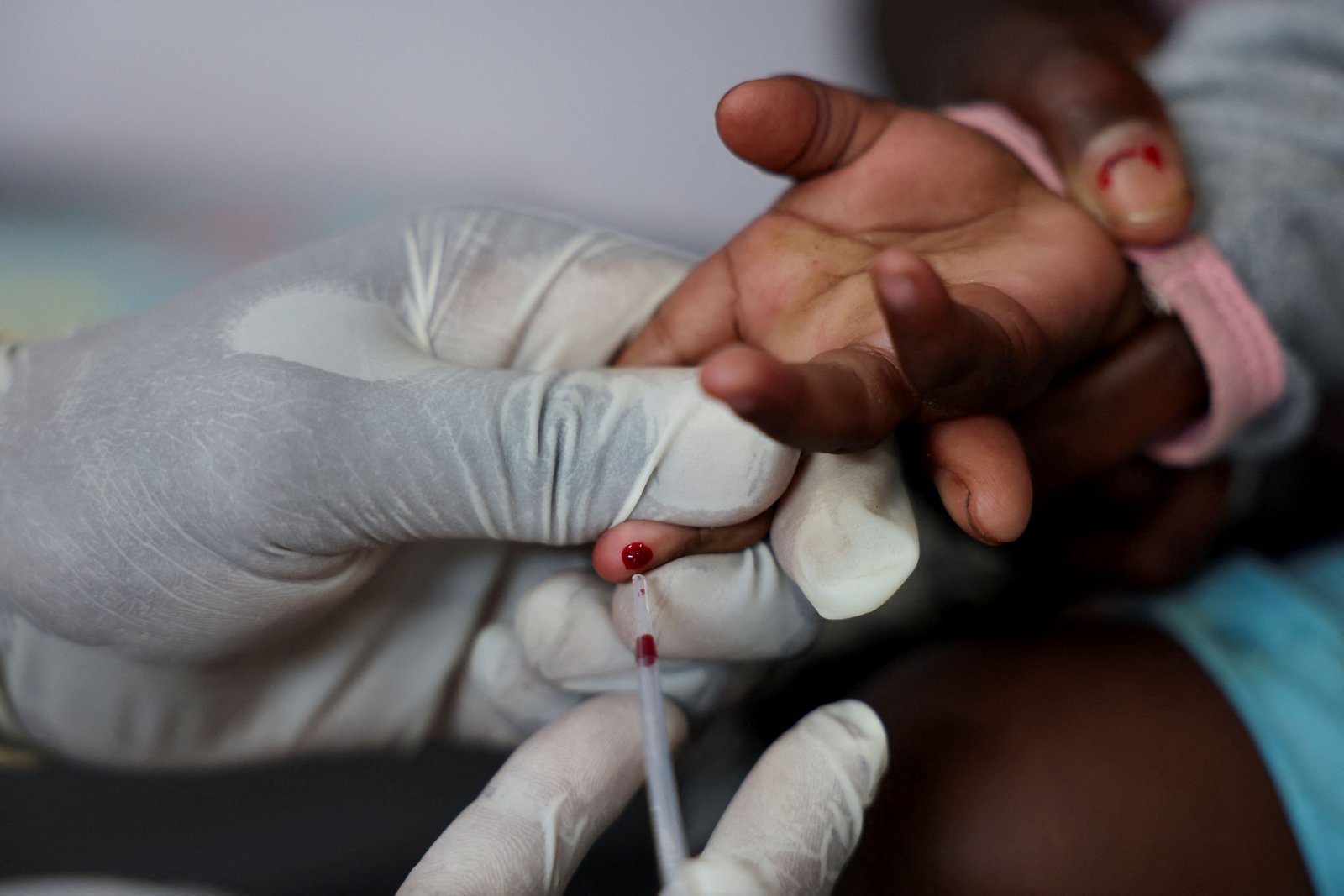 Global HIV fight faces major challenges