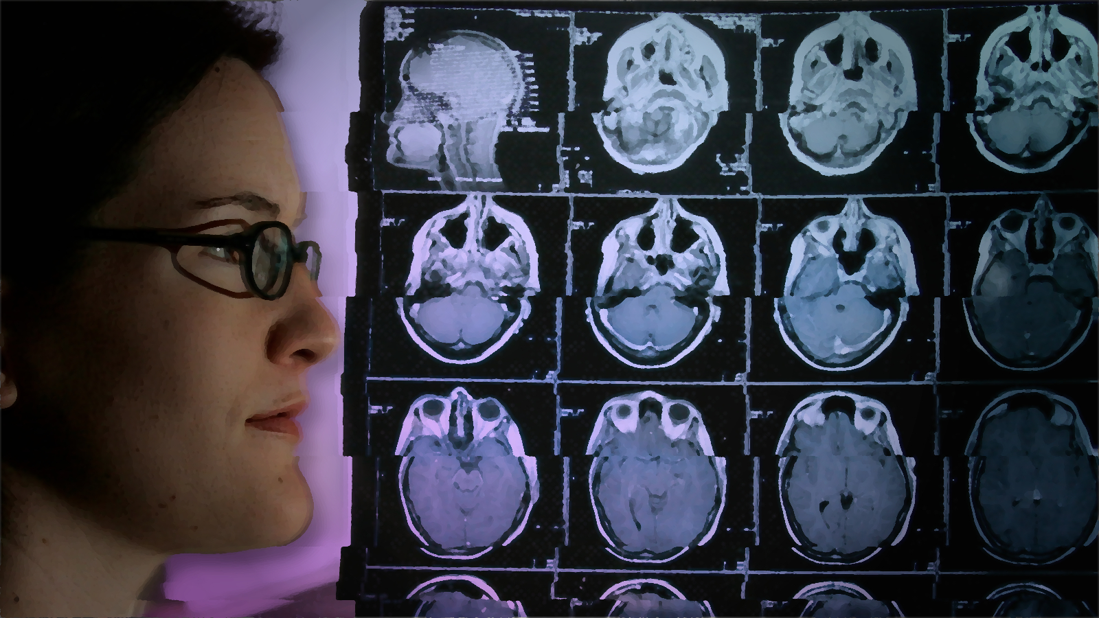  Brain Tumors, Big Pharma, And A Legal Escape Hatch 