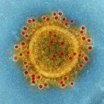 How a Measles Outbreak Begins, Featuring the State of Colorado