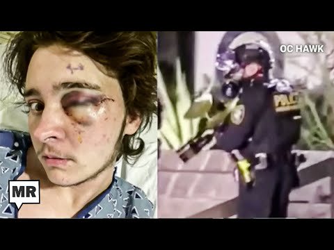 ICE Blinds Man After Shooting Him Point Blank In The Face